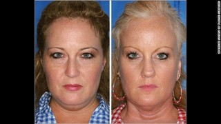 03-twins-smoking-horizontal-gallery.jpg