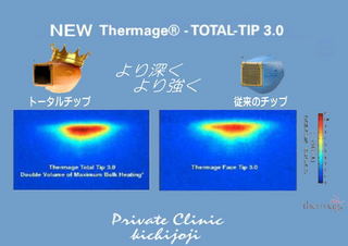 Thermag111.jpg